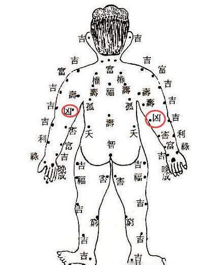 破財痣|身上最不可留的4顆痣，破財又招小人